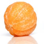Auch eine Orangenhaut (Cellulite) kann mit einem Dermaroller behandelt werden.